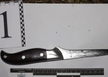 Лишила сожителя ноги: в Одесской области в результате ссоры пострадал мужчина