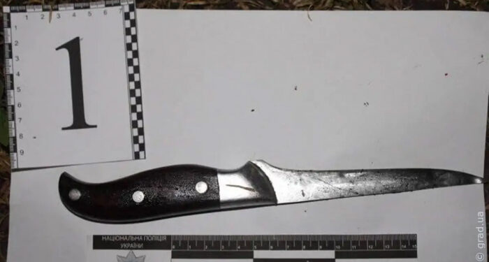 Лишила сожителя ноги: в Одесской области в результате ссоры пострадал мужчина