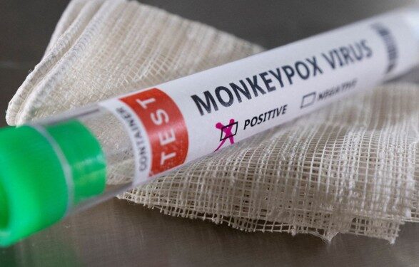 В Ирландии сообщили о первом случае заражения вирусом обезьяньей оспы