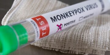 В Бразилии зафиксировали первый случай оспы обезьян у человека