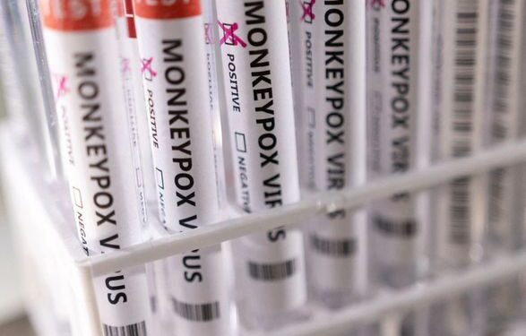 Немецкий комитет по вакцинации рекомендовал прививку взрослым с риском заражения обезьяньей оспой