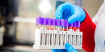 В Украине за неделю зафиксировано около 1,6 тыс. случаев ковида, 34 – летальных