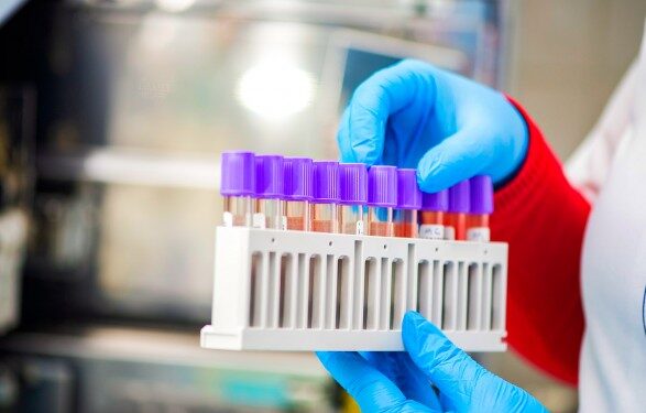 В Украине за неделю зафиксировано около 1,6 тыс. случаев ковида, 34 – летальных