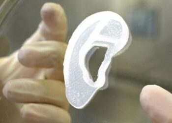 Врачи пересадили ухо из клеток человека, сделанное с помощью 3D-принтера