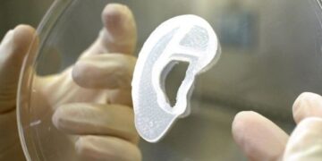 Врачи пересадили ухо из клеток человека, сделанное с помощью 3D-принтера