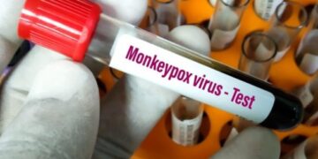 В Нидерландах выявили 167 случаев инфицирования обезьяньей оспой