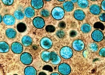 Возбудитель обезьяной оспы неожиданно сильно мутировал: исследование