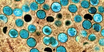 Возбудитель обезьяной оспы неожиданно сильно мутировал: исследование
