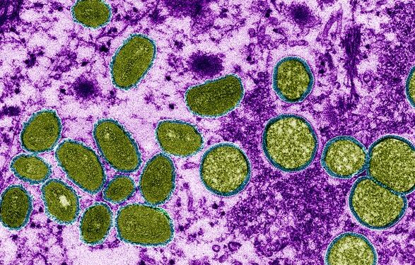 ВОЗ предупреждает о росте заболеваемости коронавирусом и обезьяньей оспой