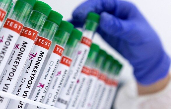 В Калифорнии из-за оспы обезьян объявлено чрезвычайное положение