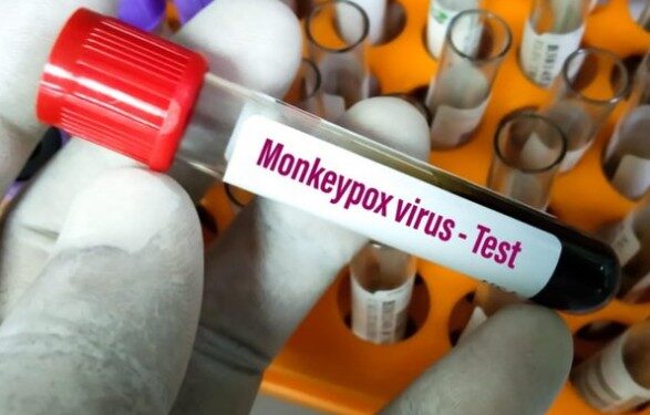 В Испании сообщили о второй смерти от обезьяньей оспы