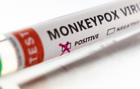 Мексика и Куба сообщили о смерти двух человек, у которых был положительный результат теста на обезьянью оспу