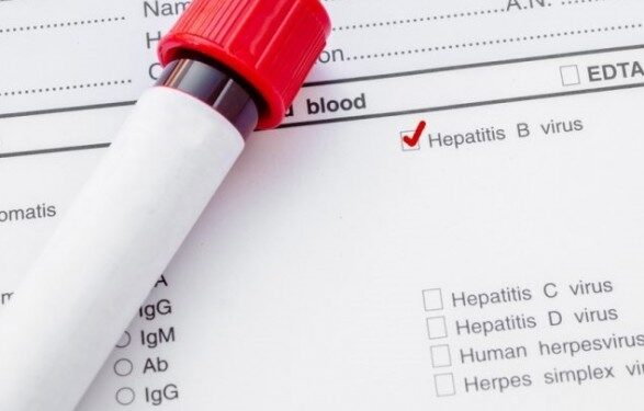 Медики предупредили: на фоне войны лечиться от вирусных гепатитов начали вдвое меньше людей