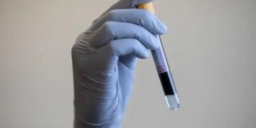 Простой анализ крови может выявлять различные виды рака до появления симптомов — исследование