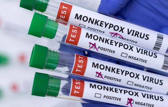 Обезьяную оспу переименуют в mpox