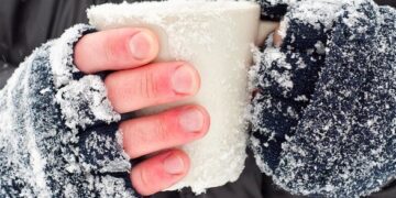 Что делать в случае обморожения: инструкция от Минздрава