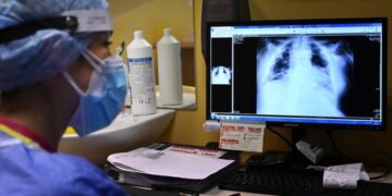 Рост количества случаев туберкулеза будет в послевоенные времена — Минздрав