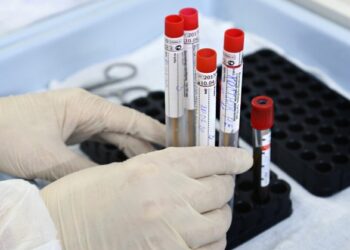 В Украине подвид коронавируса «Кракен» впервые нашли в сточных водах