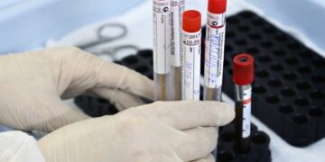 В Украине подвид коронавируса «Кракен» впервые нашли в сточных водах