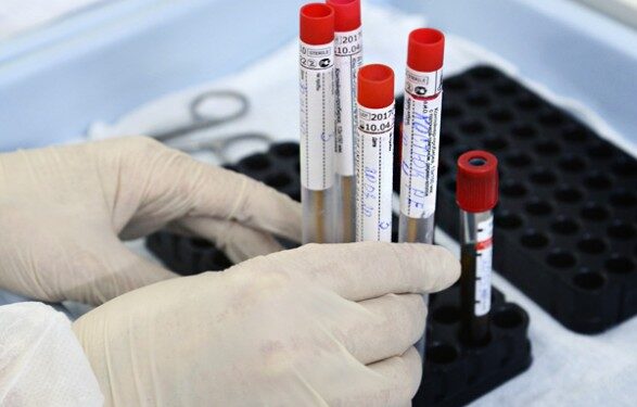 В Украине подвид коронавируса «Кракен» впервые нашли в сточных водах