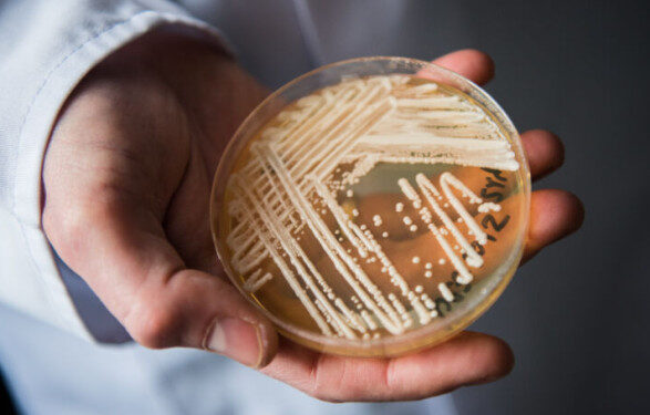 В США распространяется устойчивый к лекарствам потенциально смертельный грибок: его резистентность выросла на фоне COVID