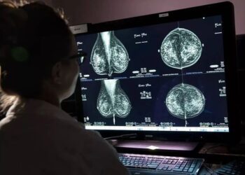 Группа здоровья США рекомендует женщинам проходить маммографию уже с 40 лет