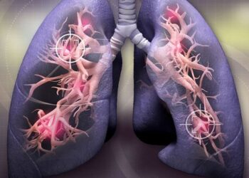 Таблетки от рака легких снижают риск смерти вдвое — исследование