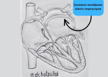В Одесі прооперували маленького хлопчика з рідкою аномалією серця — Одеса
