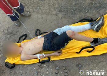 Влізли на потяг, щоб сфотографуватись: на Одещині двоє підлітків отримали удари струмом