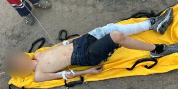 Влізли на потяг, щоб сфотографуватись: на Одещині двоє підлітків отримали удари струмом