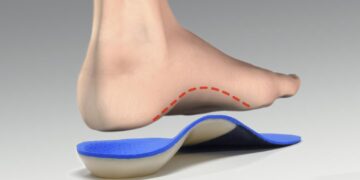 Зачем нужны ортопедические стельки?