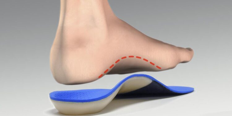 Зачем нужны ортопедические стельки?