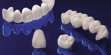 Что такое циркониевые коронки и их преимущества?