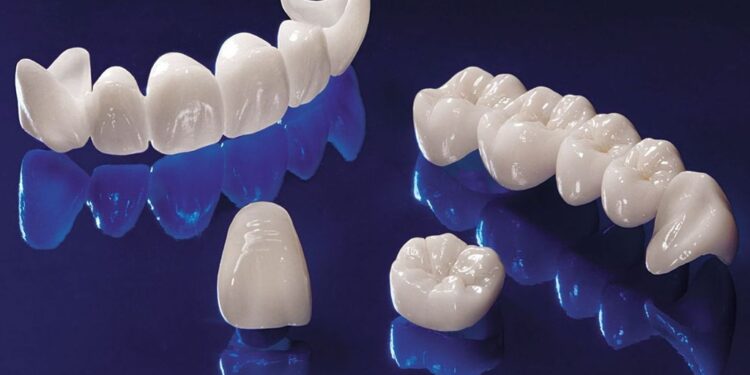 Что такое циркониевые коронки и их преимущества?