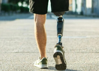 Бесплатное протезирование: как работает госпрограмма » Новости Одессы |