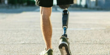 Бесплатное протезирование: как работает госпрограмма » Новости Одессы |