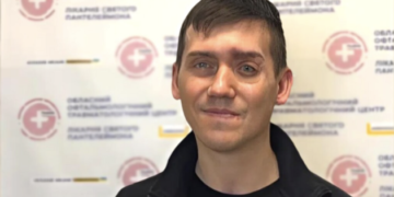 Волонтер з екзопротезом на обличчі: Люди не помічають, що в мене немає ока