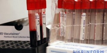 У березні в Україні офіційно зареєстрували 617 випадків ВІЛ-інфекції